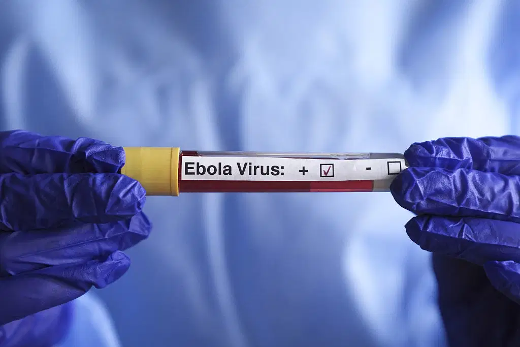Fransa’da Ebola alarmı: İlk vaka tespit edildi